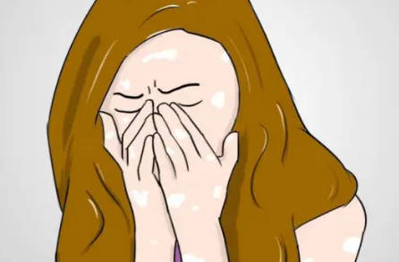 白癜风并发症揭秘：这些风险你可能不知道！